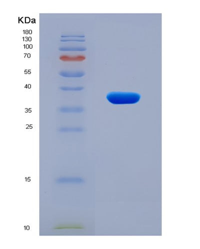SDS-PAGE analysis of Mouse Cd44 (Cd44 Antigen) - Recombinant Protein, CAT# BLT-08125P, showing >90% purity under 15% SDS-PAGE (Reduced)Mouse Cd44 (Cd44 Antigen) - Recombinant Protein