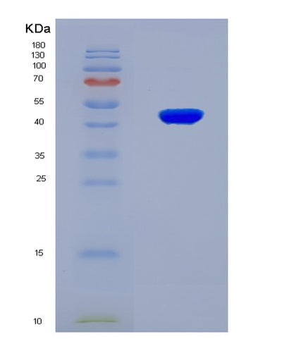 SDS-PAGE analysis of Mouse Hp (Haptoglobin) - Recombinant Protein, CAT# BLT-08126P, showing >90% purity under 15% SDS-PAGE (Reduced)Mouse Hp (Haptoglobin) - Recombinant Protein