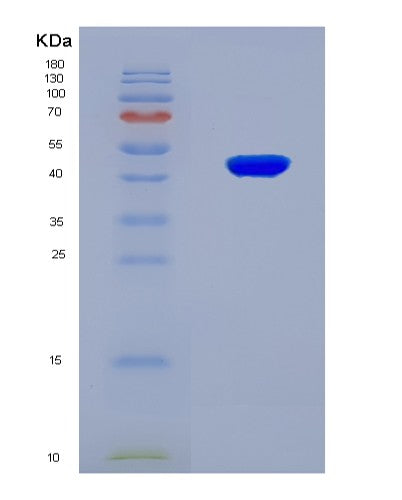 SDS-PAGE analysis of Mouse Hp (Haptoglobin) - Recombinant Protein, CATMouse Hp (Haptoglobin) - Recombinant Protein