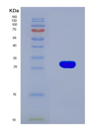 SDS-PAGE analysis of Mouse Hvcn1 (Voltage-Gated Hydrogen Channel 1) - Recombinant Protein, CAT# BLT-08128P, showing >90% purity under 15% SDS-PAGE (Reduced)Mouse Hvcn1 (Voltage-Gated Hydrogen Channel 1) - Recombinant Protein
