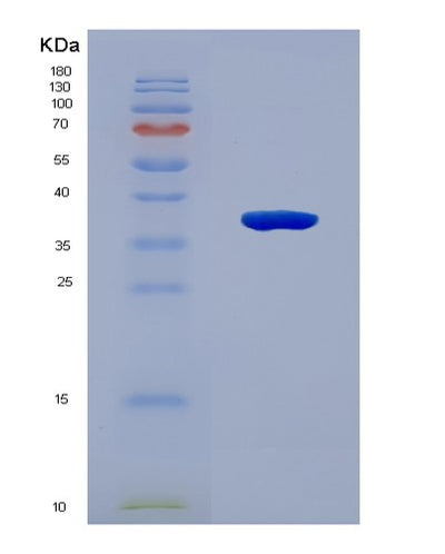 SDS-PAGE analysis of Human OSR2 (Protein Odd-Skipped-Related 2) - Recombinant Protein, CAT# BLT-08129P, showing >90% purity under 15% SDS-PAGE (Reduced)Human OSR2 (Protein Odd-Skipped-Related 2) - Recombinant Protein