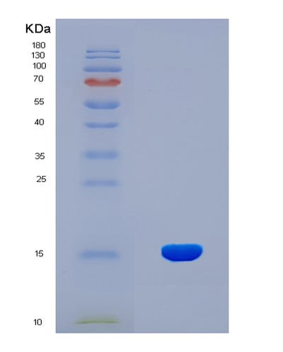 SDS-PAGE analysis of Human MIA (Melanoma-Derived Growth Regulatory Protein) - Recombinant Protein, CAT# BLT-08130P, showing >90% purity under 15% SDS-PAGE (Reduced)Human MIA (Melanoma-Derived Growth Regulatory Protein) - Recombinant Protein