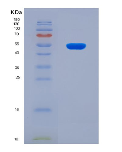 SDS-PAGE analysis of Human KLK6 (Kallikrein-6) - Recombinant Protein, CAT# BLT-08131P, showing >90% purity under 15% SDS-PAGE (Reduced)Human KLK6 (Kallikrein-6) - Recombinant Protein