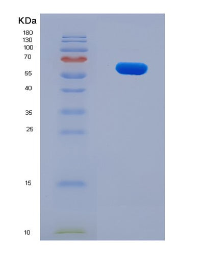 SDS-PAGE analysis of Human LGI4 (Leucine-Rich Repeat Lgi Family Member 4) - Recombinant Protein, CAT# BLT-08133P, showing >90% purity under 15% SDS-PAGE (Reduced)Human LGI4 (Leucine-Rich Repeat Lgi Family Member 4) - Recombinant Protein