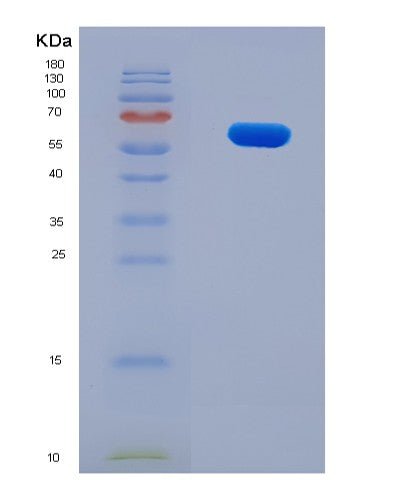 SDS-PAGE analysis of Human LGI4 (Leucine-Rich Repeat Lgi Family Member 4) - Recombinant Protein, CATHuman LGI4 (Leucine-Rich Repeat Lgi Family Member 4) - Recombinant Protein