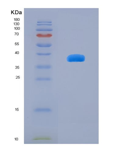 SDS-PAGE analysis of Human TPH2 (Tryptophan 5-Hydroxylase 2) - Recombinant Protein, CAT# BLT-08136P, showing >90% purity under 15% SDS-PAGE (Reduced)Human TPH2 (Tryptophan 5-Hydroxylase 2) - Recombinant Protein