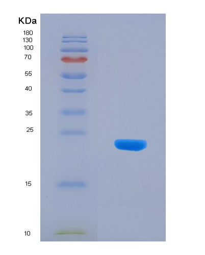 SDS-PAGE analysis of Human RPP25 (Ribonuclease P Protein Subunit P25) - Recombinant Protein, CATHuman RPP25 (Ribonuclease P Protein Subunit P25) - Recombinant Protein