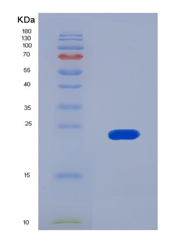 SDS-PAGE analysis of Human IARS1 (Isoleucine--Trna Ligase, Cytoplasmic) - Recombinant Protein, CAT# BLT-08139P, showing >90% purity under 15% SDS-PAGE (Reduced)Human IARS1 (Isoleucine--Trna Ligase, Cytoplasmic) - Recombinant Protein