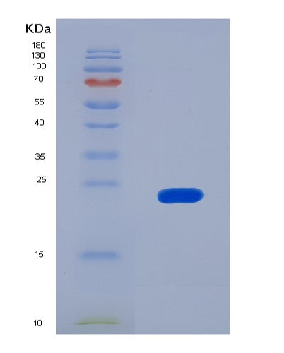 SDS-PAGE analysis of Human IARS1 (Isoleucine--Trna Ligase, Cytoplasmic) - Recombinant Protein, CATHuman IARS1 (Isoleucine--Trna Ligase, Cytoplasmic) - Recombinant Protein