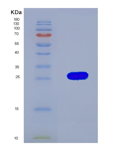 SDS-PAGE analysis of Human DDAH2 (Putative Hydrolase Ddah2) - Recombinant Protein, CATHuman DDAH2 (Putative Hydrolase Ddah2) - Recombinant Protein