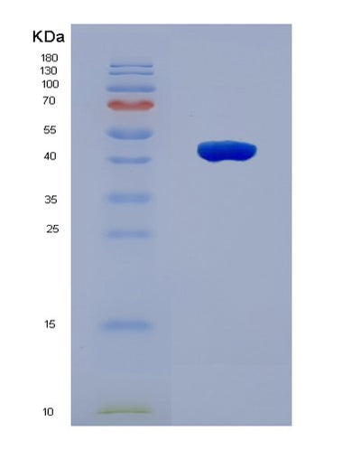 SDS-PAGE analysis of Human NEU2 (Sialidase-2) - Recombinant Protein, CAT# BLT-08142P, showing >90% purity under 15% SDS-PAGE (Reduced)Human NEU2 (Sialidase-2) - Recombinant Protein