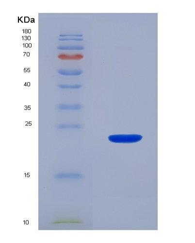 SDS-PAGE analysis of Mouse Itgam (Integrin Alpha-M) - Recombinant Protein, CATMouse Itgam (Integrin Alpha-M) - Recombinant Protein