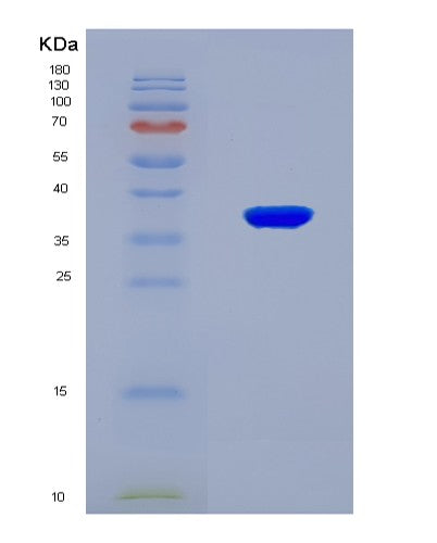 SDS-PAGE analysis of Mouse Cbs (Cystathionine Beta-Synthase) - Recombinant Protein, CATMouse Cbs (Cystathionine Beta-Synthase) - Recombinant Protein
