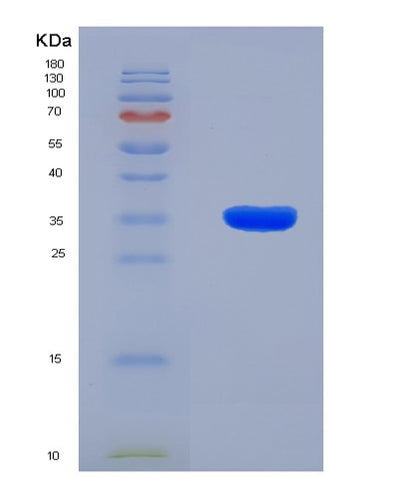 SDS-PAGE analysis of Human IFITM1 (Interferon-Induced Transmembrane Protein 1) - Recombinant Protein, CAT# BLT-08145P, showing >90% purity under 15% SDS-PAGE (Reduced)Human IFITM1 (Interferon-Induced Transmembrane Protein 1) - Recombinant Protein