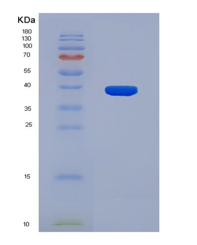 SDS-PAGE analysis of Human SIGMAR1 (Sigma Non-Opioid Intracellular Receptor 1) - Recombinant Protein, CAT# BLT-08146P, showing >90% purity under 15% SDS-PAGE (Reduced)Human SIGMAR1 (Sigma Non-Opioid Intracellular Receptor 1) - Recombinant Protein