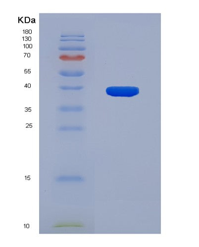 SDS-PAGE analysis of Human SIGMAR1 (Sigma Non-Opioid Intracellular Receptor 1) - Recombinant Protein, CATHuman SIGMAR1 (Sigma Non-Opioid Intracellular Receptor 1) - Recombinant Protein