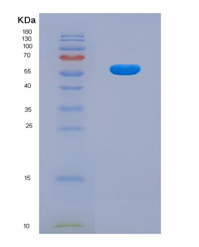 SDS-PAGE analysis of Mouse Prss8 (Prostasin) - Recombinant Protein, CATMouse Prss8 (Prostasin) - Recombinant Protein