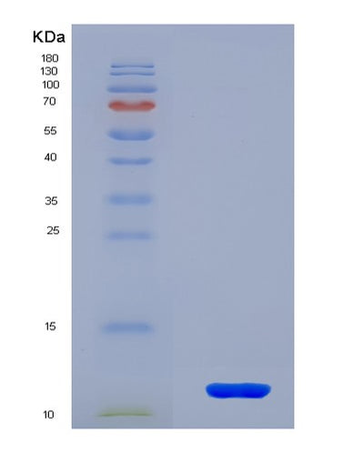 SDS-PAGE analysis of Mouse Gpx3 (Glutathione Peroxidase 3) - Recombinant Protein, CAT# BLT-08148P, showing >90% purity under 15% SDS-PAGE (Reduced)Mouse Gpx3 (Glutathione Peroxidase 3) - Recombinant Protein