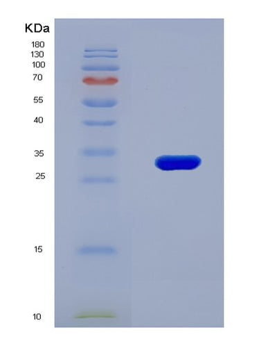 SDS-PAGE analysis of Human AHR (Aryl Hydrocarbon Receptor) - Recombinant Protein, CAT# BLT-08149P, showing >90% purity under 15% SDS-PAGE (Reduced)Human AHR (Aryl Hydrocarbon Receptor) - Recombinant Protein