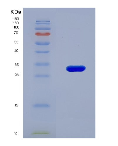 SDS-PAGE analysis of Human AHR (Aryl Hydrocarbon Receptor) - Recombinant Protein, CATHuman AHR (Aryl Hydrocarbon Receptor) - Recombinant Protein