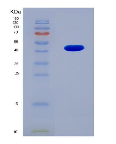 SDS-PAGE analysis of Human NEFH (Neurofilament Heavy Polypeptide) - Recombinant Protein, CAT# BLT-08151P, showing >90% purity under 15% SDS-PAGE (Reduced)Human NEFH (Neurofilament Heavy Polypeptide) - Recombinant Protein