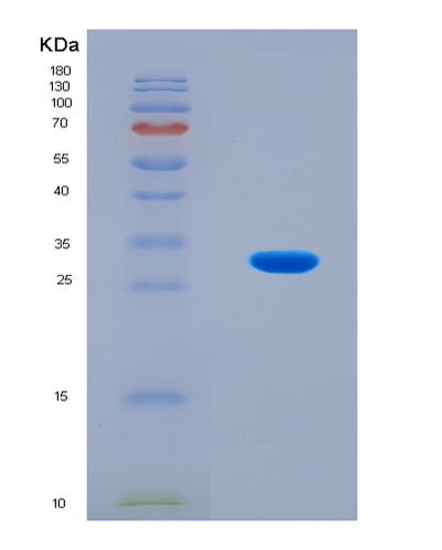 SDS-PAGE analysis of Human PGR (Progesterone Receptor) - Recombinant Protein, CAT# BLT-08153P, showing >90% purity under 15% SDS-PAGE (Reduced)Human PGR (Progesterone Receptor) - Recombinant Protein