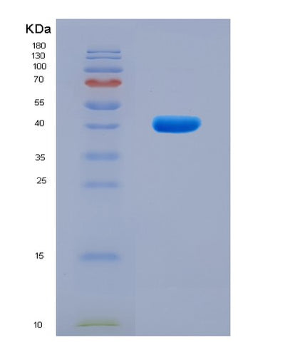 SDS-PAGE analysis of Human GNRHR (Gonadotropin-Releasing Hormone Receptor) - Recombinant Protein, CAT# BLT-08154P, showing >90% purity under 15% SDS-PAGE (Reduced)Human GNRHR (Gonadotropin-Releasing Hormone Receptor) - Recombinant Protein
