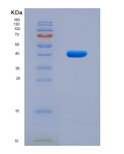 SDS-PAGE analysis of Human GNRHR (Gonadotropin-Releasing Hormone Receptor) - Recombinant Protein, CATHuman GNRHR (Gonadotropin-Releasing Hormone Receptor) - Recombinant Protein