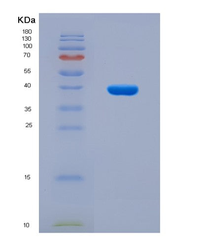 SDS-PAGE analysis of Human ESR1 (Estrogen Receptor) - Recombinant Protein, CATHuman ESR1 (Estrogen Receptor) - Recombinant Protein