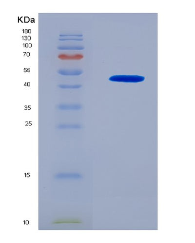 SDS-PAGE analysis of Human MVD (Diphosphomevalonate Decarboxylase) - Recombinant Protein, CAT# BLT-08156P, showing >90% purity under 15% SDS-PAGE (Reduced)Human MVD (Diphosphomevalonate Decarboxylase) - Recombinant Protein