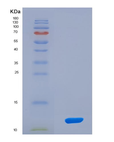 SDS-PAGE analysis of Human ESR2 (Estrogen Receptor Beta) - Recombinant Protein, CAT# BLT-08157P, showing >90% purity under 15% SDS-PAGE (Reduced)Human ESR2 (Estrogen Receptor Beta) - Recombinant Protein