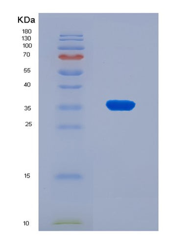SDS-PAGE analysis of Human TMEM59 (Transmembrane Protein 59) - Recombinant Protein, CAT# BLT-08158P, showing >90% purity under 15% SDS-PAGE (Reduced)Human TMEM59 (Transmembrane Protein 59) - Recombinant Protein