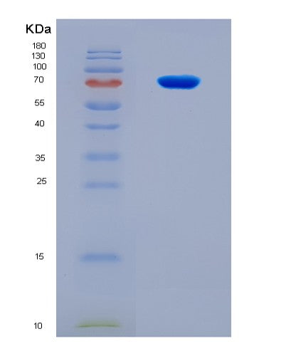 SDS-PAGE analysis of Mouse Pi16 (Peptidase Inhibitor 16) - Recombinant Protein, CATMouse Pi16 (Peptidase Inhibitor 16) - Recombinant Protein