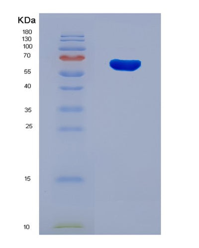 SDS-PAGE analysis of Human FTO (Alpha-Ketoglutarate-Dependent Dioxygenase Fto) - Recombinant Protein, CAT# BLT-08160P, showing >90% purity under 15% SDS-PAGE (Reduced)Human FTO (Alpha-Ketoglutarate-Dependent Dioxygenase Fto) - Recombinant Protein