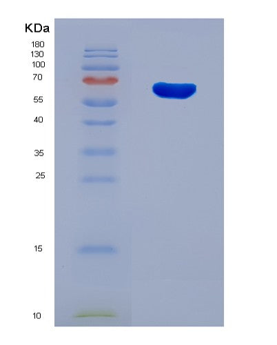 SDS-PAGE analysis of Human FTO (Alpha-Ketoglutarate-Dependent Dioxygenase Fto) - Recombinant Protein, CATHuman FTO (Alpha-Ketoglutarate-Dependent Dioxygenase Fto) - Recombinant Protein