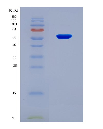 SDS-PAGE analysis of Human DCTN4 (Dynactin Subunit 4) - Recombinant Protein, CATHuman DCTN4 (Dynactin Subunit 4) - Recombinant Protein