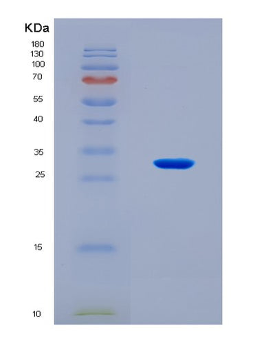 SDS-PAGE analysis of Human IRAK4 (Interleukin-1 Receptor-Associated Kinase 4) - Recombinant Protein, CAT# BLT-08163P, showing >90% purity under 15% SDS-PAGE (Reduced)Human IRAK4 (Interleukin-1 Receptor-Associated Kinase 4) - Recombinant Protein