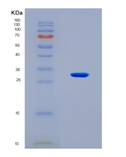 SDS-PAGE analysis of Human IRAK4 (Interleukin-1 Receptor-Associated Kinase 4) - Recombinant Protein, CATHuman IRAK4 (Interleukin-1 Receptor-Associated Kinase 4) - Recombinant Protein