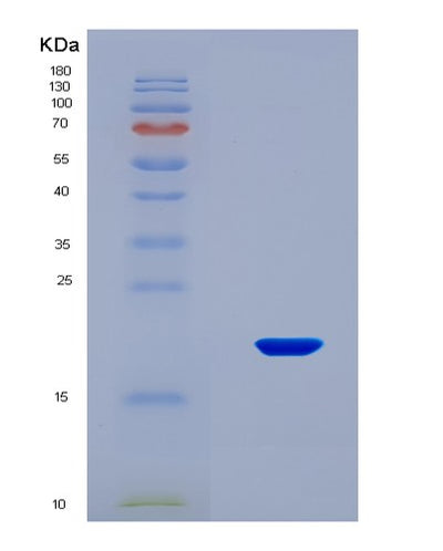 SDS-PAGE analysis of Human PDGFA (Platelet-Derived Growth Factor Subunit A) - Recombinant Protein, CAT# BLT-08165P, showing >90% purity under 15% SDS-PAGE (Reduced)Human PDGFA (Platelet-Derived Growth Factor Subunit A) - Recombinant Protein