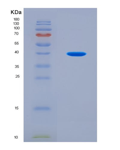 SDS-PAGE analysis of Human MAP1LC3B (Microtubule-Associated Protein 1 Light Chain 3 Beta) - Recombinant Protein, CAT# BLT-08166P, showing >90% purity under 15% SDS-PAGE (Reduced)Human MAP1LC3B (Microtubule-Associated Protein 1 Light Chain 3 Beta) - Recombinant Protein