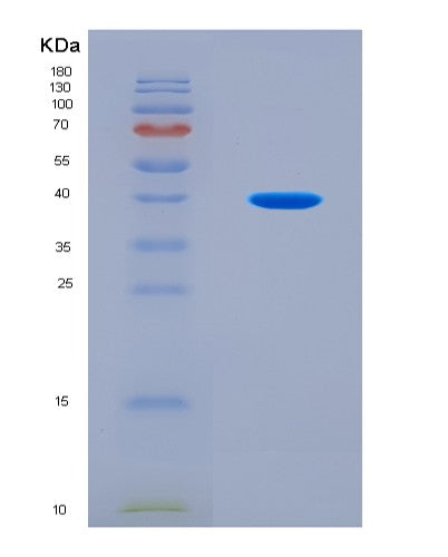 SDS-PAGE analysis of Human MAP1LC3B (Microtubule-Associated Protein 1 Light Chain 3 Beta) - Recombinant Protein, CATHuman MAP1LC3B (Microtubule-Associated Protein 1 Light Chain 3 Beta) - Recombinant Protein