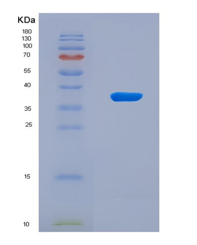 SDS-PAGE analysis of Human AQP1 (Aquaporin-1) - Recombinant Protein, CAT# BLT-08167P, showing >90% purity under 15% SDS-PAGE (Reduced)Human AQP1 (Aquaporin-1) - Recombinant Protein
