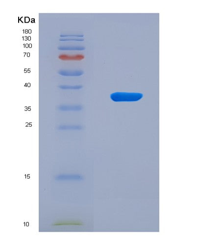 SDS-PAGE analysis of Human AQP1 (Aquaporin-1) - Recombinant Protein, CATHuman AQP1 (Aquaporin-1) - Recombinant Protein