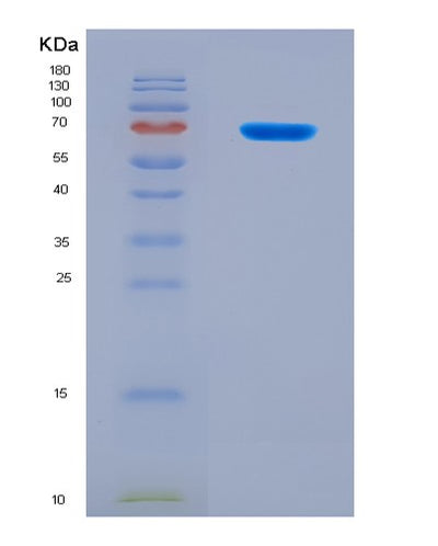 SDS-PAGE analysis of Human DNER (Delta And Notch-Like Epidermal Growth Factor-Related Receptor) - Recombinant Protein, CAT# BLT-08170P, showing >90% purity under 15% SDS-PAGE (Reduced)Human DNER (Delta And Notch-Like Epidermal Growth Factor-Related Receptor) - Recombinant Protein