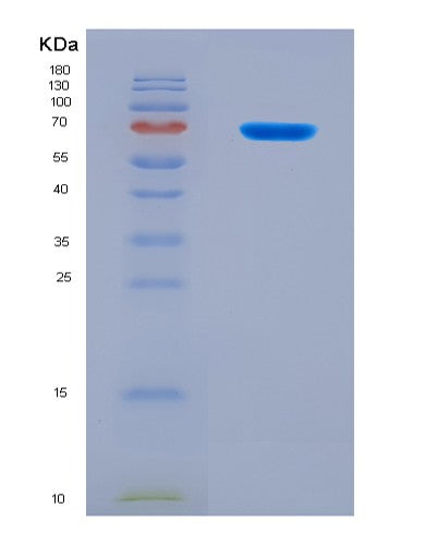 SDS-PAGE analysis of Human DNER (Delta And Notch-Like Epidermal Growth Factor-Related Receptor) - Recombinant Protein, CATHuman DNER (Delta And Notch-Like Epidermal Growth Factor-Related Receptor) - Recombinant Protein