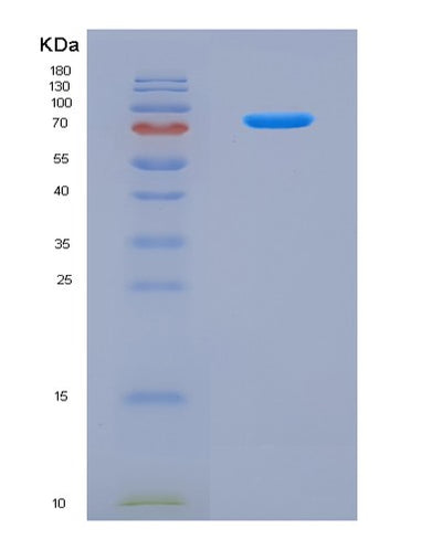 SDS-PAGE analysis of Human CAMK2B (Calcium/Calmodulin-Dependent Protein Kinase Type Ii Subunit Beta) - Recombinant Protein, CAT# BLT-08171P, showing >90% purity under 15% SDS-PAGE (Reduced)Human CAMK2B (Calcium/Calmodulin-Dependent Protein Kinase Type Ii Subunit Beta) - Recombinant Protein