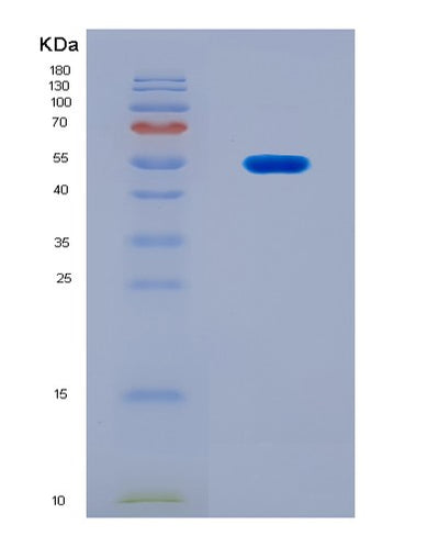 SDS-PAGE analysis of Human ATP2A2 (Sarcoplasmic/Endoplasmic Reticulum Calcium Atpase 2) - Recombinant Protein, CAT# BLT-08172P, showing >90% purity under 15% SDS-PAGE (Reduced)Human ATP2A2 (Sarcoplasmic/Endoplasmic Reticulum Calcium Atpase 2) - Recombinant Protein