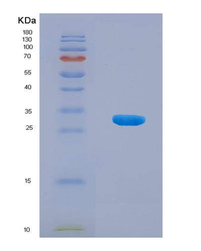 SDS-PAGE analysis of Human DNASE1 (Deoxyribonuclease-1) - Recombinant Protein, CAT# BLT-08173P, showing >90% purity under 15% SDS-PAGE (Reduced)Human DNASE1 (Deoxyribonuclease-1) - Recombinant Protein