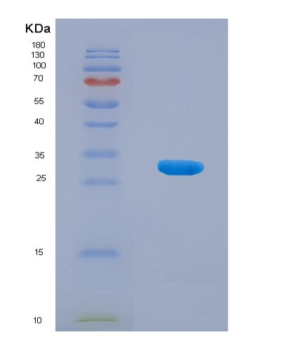 SDS-PAGE analysis of Human DNASE1 (Deoxyribonuclease-1) - Recombinant Protein, CATHuman DNASE1 (Deoxyribonuclease-1) - Recombinant Protein