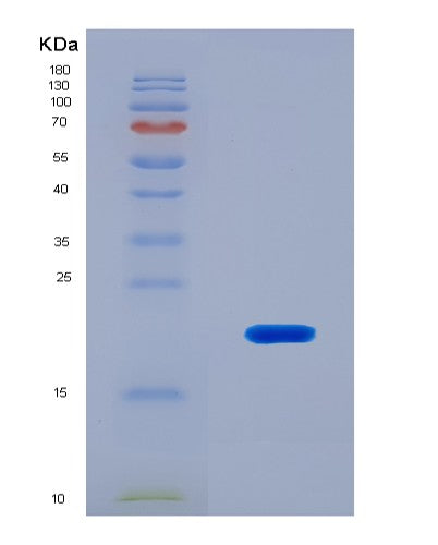 SDS-PAGE analysis of Human FCGBP (Iggfc-Binding Protein) - Recombinant Protein, CATHuman FCGBP (Iggfc-Binding Protein) - Recombinant Protein